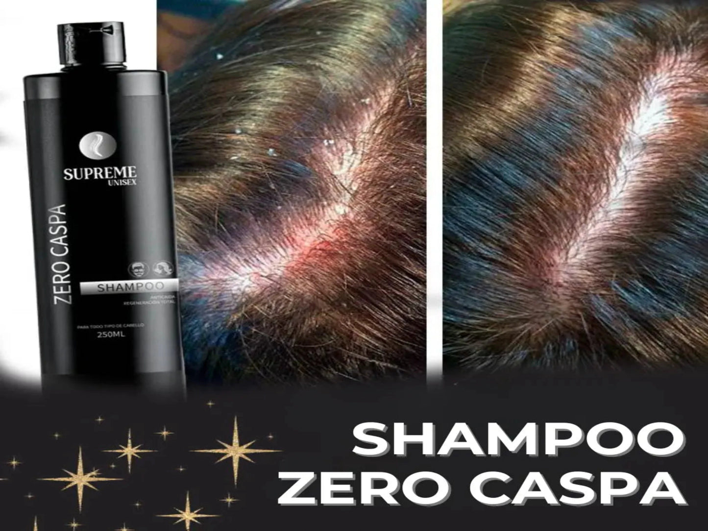 SHAMPOO ZERO CASPA